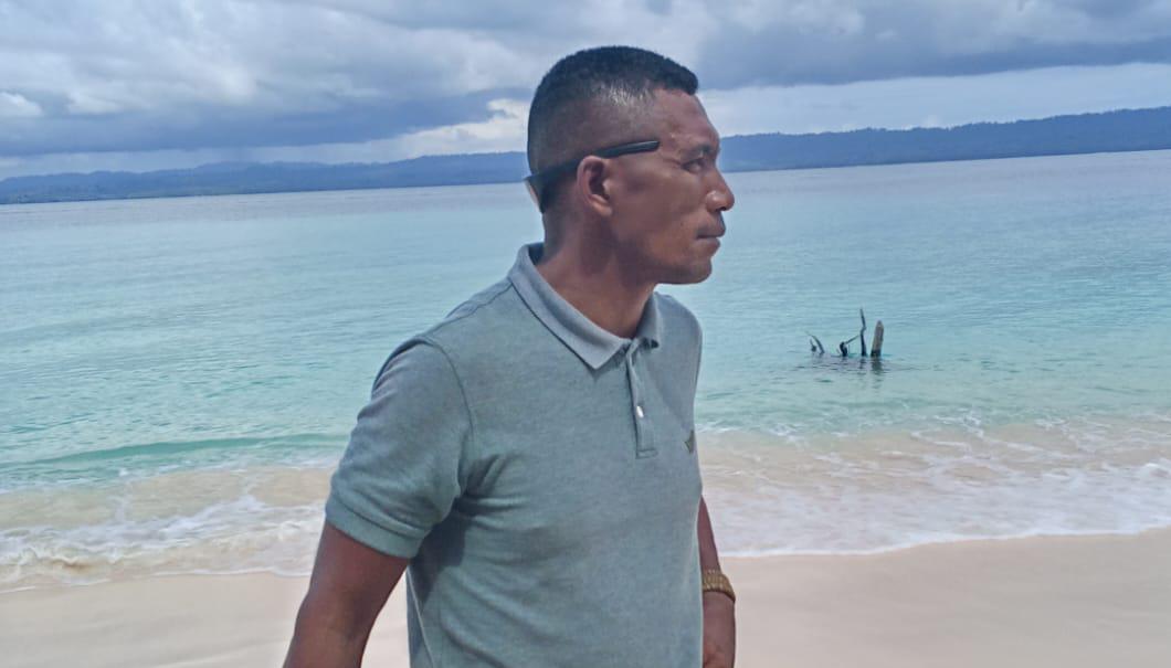 Rambo Gigi Copot, Diduga Dianiaya Oknum Brimob
